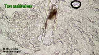 Demodex folliculorum mit Ei im Bauch [upl. by Elitnahc572]