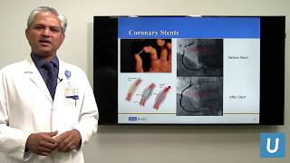 Coronary Angiography and Stent Interventions  Ravi Dave MD  UCLAMDChat [upl. by Clercq]