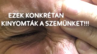 Ezek Konkrétan KINYOMTÁK A SZEMÜNKET [upl. by Amilas]