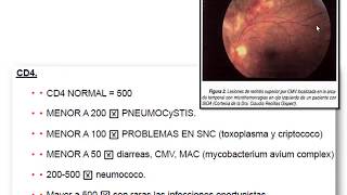 EUNACOM UPV  Infectología 02 [upl. by Niraj]