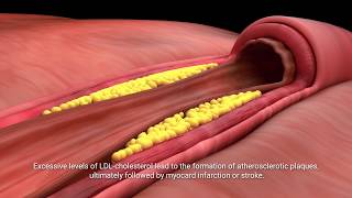 Lactobacillus plantarum INDUCIA [upl. by Kudva]