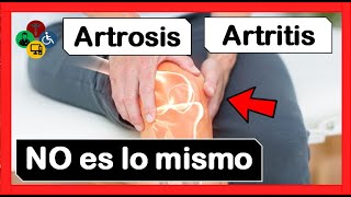 ¿Cuales son las DIFERENCIAS ARTRITIS Y ARTROSIS [upl. by Ahsrats702]