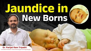 Jaundice in Newborns  DrParijat Ram Tripathi  Ankura Hospitals Hyderabad [upl. by Aelhsa]