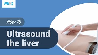 How to ultrasound the liver [upl. by Aryad]