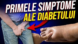 Află Care sunt Primele SIMPTOME ale Diabetului până nu sa Făcut Prea TÂRZIU [upl. by Eille328]