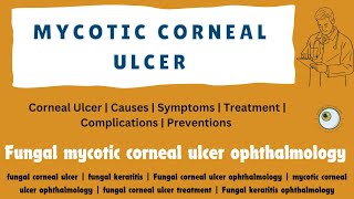 Fungal corneal ulcer  Fungal keratitis   Mycotic corneal ulcer Ophthalmology OptometryFans [upl. by Marston]