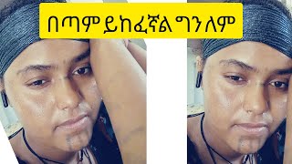 ኩራዝ ለሰዉ ፍቅር kuraz ቲዩብደራ is liveበጣም ይከፈኛል ግን ለም [upl. by Nuawd]