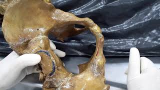 Clase de pelvis anatomía parte 1 281119 HD 1080p [upl. by Dlarrej]