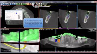 Software 3Diagnosys [upl. by Eemia]