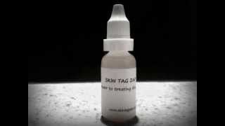 Skin Tag Remover  removing skin tags the natural way Skin Tag Zap [upl. by Timms246]