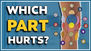 My knee hurts here 10 typical pain spots and what they mean [upl. by Latona]