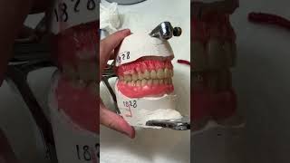 TryIn Festooning dentist dental teeth denture shortvideo shorts short dentallab smile [upl. by Latreese]