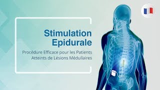 Stimulation Epidurale Procédure Efficace pour les Patients Atteints de Lésions Médullaires [upl. by Adirehs]