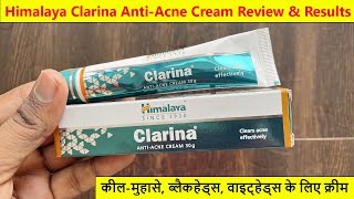 Himalaya Clarina Anti Acne Cream Honest Review  Benefits side effect Uses  supriyatheclassytips [upl. by Nobell]