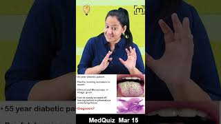 Medquiz 15 [upl. by Aggappora450]