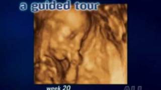 Echographie vidéo 3D du foetus [upl. by Thor]