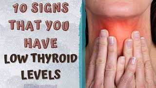 SIGNS THAT YOU HAVE A LOW THYROID LEVEL  Hypothyroidism Symptoms [upl. by Erised335]