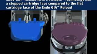 Endo GIA Ultra  Endo GIA Tri Staple CovidienMedtronic [upl. by Eeliram168]