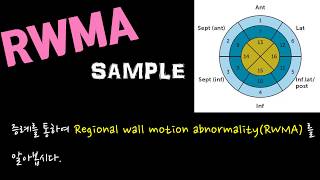 초보자를 위한 심장초음파 검사  RWMA Regional wall motion abnormality [upl. by Yeffej]