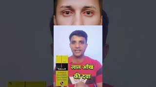 लाल आँख की दवा।। tobra d eye drop shorts short trending youtube [upl. by Bertsche]