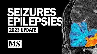 Seizures and Epilepsies 2023 [upl. by Yneffit577]