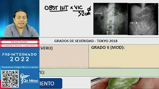 COLECISTITIS AGUDA  Dolor Biliar  Criterios de Tokio  CIRUGIA GENERAL  QX MEDIC [upl. by Chas]