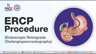 What is ERCP Test and How it is done  Department of Gastroenterology  Pace Hospitals [upl. by Dane]