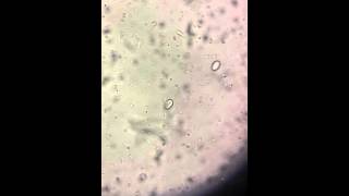 Giardia Lamblia trophozoite [upl. by Dachi]