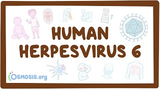 Human herpesvirus 6 Roseola  an Osmosis Preview [upl. by Anaert]