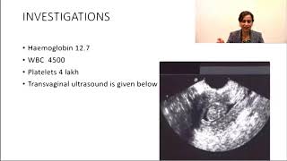 NEETPG Intermenstrual bleeding by Dr Deepti Bahl [upl. by Atinehc]