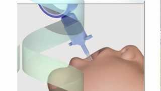 Neonatal Endotracheal Intubation [upl. by Henry]