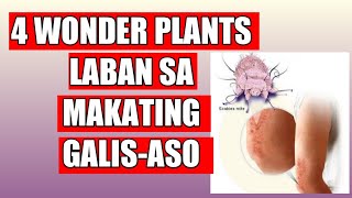 144 4 wonder plants Laban sa Makating GalisAsoscabies  Likas Lunas [upl. by Ellie]