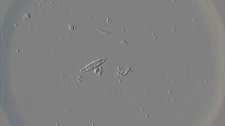 Diatoms in action [upl. by Ferdy]