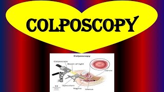 What is a Colposcopy  Colposcopy  Biopsy Purpose Procedure Risks and Results [upl. by Senoj]