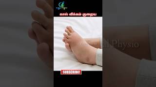 how to reduce swelling in legs  swelling in legs home remedies  how to treat edema naturally [upl. by Aara624]