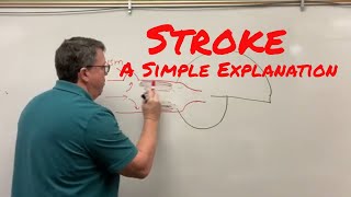 Stroke Cerebrovascular Accident A Simple Explanation [upl. by Aim]