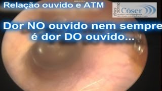 Dor de ouvido e ATM  Articulação têmporomandibular\Earache and temporomandibular jointTMJ [upl. by Drannel]