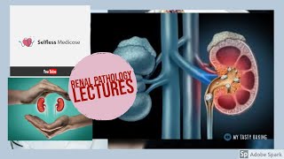 RENAL PATHOLOGY lecture 16 NEPHROSCLEROSIS [upl. by Oconnor596]