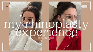 my rhinoplasty experience before and after ✨❤️‍🩹 nosejob youtuber rhinoplastybeforeandafter [upl. by Enal904]