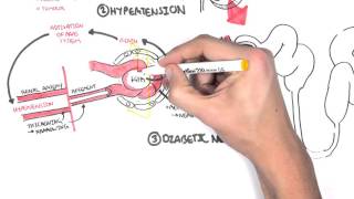 Chronic Kidney Disease CKD Pathophysiology [upl. by Eikin]