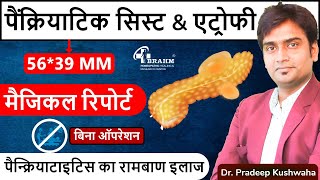 Atrophy Pancreatitis Treatment  Pseudocyst Pancreatitis treatment hindi  Best Pancreas treatment [upl. by Wavell707]