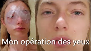 OPÉRATION HYPERMÉTROPIE FORTE ET ASTIGMATISME  Lasik [upl. by Nolyaj715]