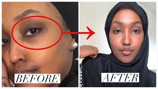 BYE 👋 les cernes amp les imperfections — MY SKINCARE ROUTINE [upl. by Nylyahs632]