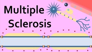 Multiple Sclerosis and the Myelin Sheath [upl. by Lamoree276]