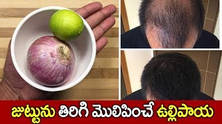 జుట్టును తిరిగి మొలిపించే ఉల్లిపాయ I Onion For Hair Growth I Health Tips I Everything in Telugu [upl. by Ociredef743]