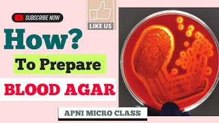 Blood agar  Principle Preparation and Observation  Notes in Hindi [upl. by Nnyleuqaj]