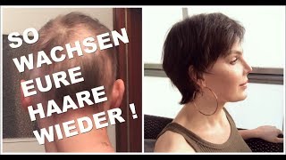 MEDIKAMENTE gegen KREISRUNDEN HAARAUSFALL 💊 MEINE THERAPIE 💉 [upl. by Ahseuqal16]