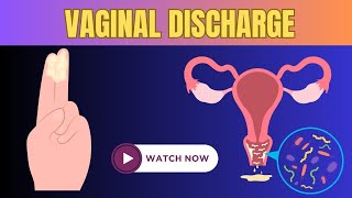 What Types Of Vaginal Discharge Are There What they mean [upl. by Norvun]