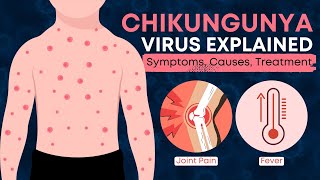 What is Chikungunya Virus  All You Need to Know About Chikungunya Virus [upl. by Ainafetse959]