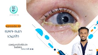 የህፃናት የአይን ኢንፌክሽን conjunctivitis in babies [upl. by Remo]